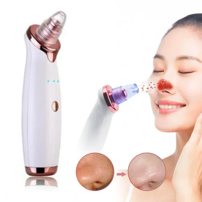 Electric Blackhead Remover