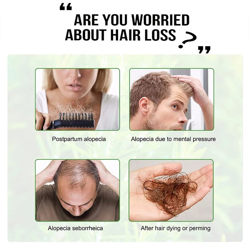 GOIPLE 30ML Rosemary Hair Oil