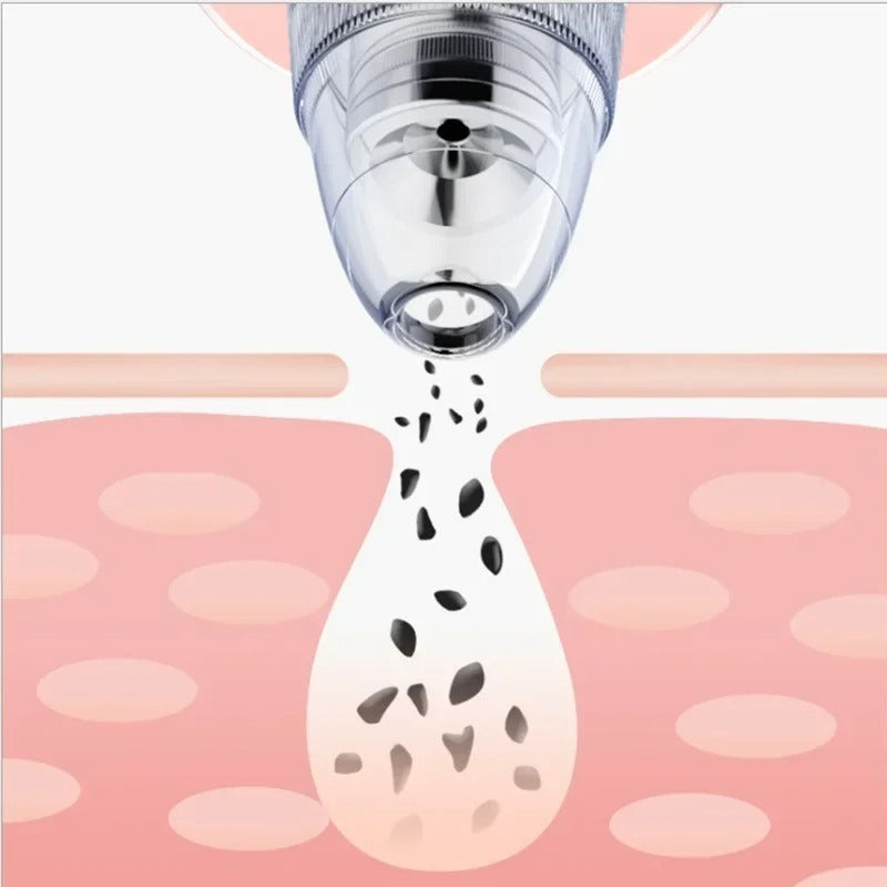 Electric Blackhead Remover